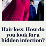 Hair loss: How do you look for a hidden infection?